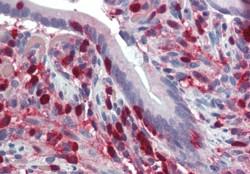 IHC - Goat Anti-S100A4 / CAPL Antibody AF1950a